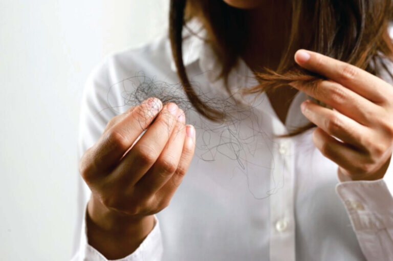 Hair Loss Prevention: Effective Methods