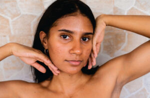 Skin Pigmentation Causes and Solutions